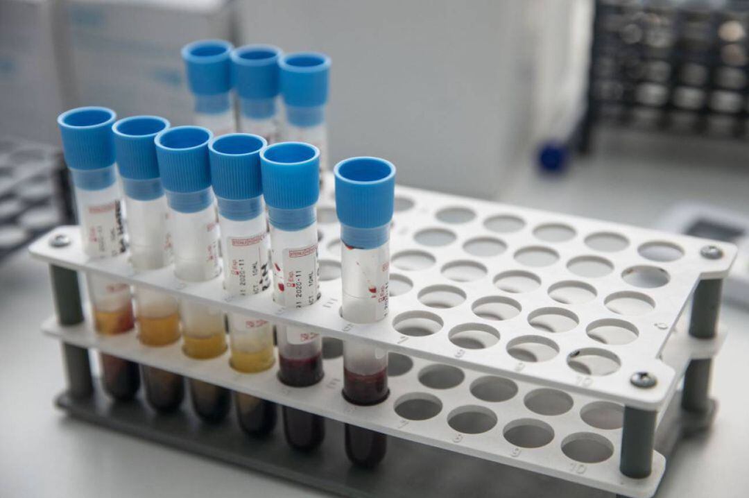 La Conselleria de Sanitat actualiza diariamente los datos positivos de Coronavirus en la Comunittat