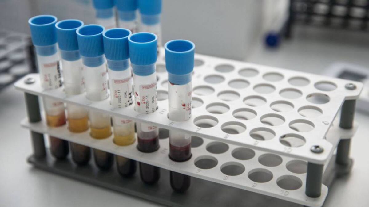 Generalitat comunica tres nuevos brotes en la costa de Castellón en las últimas 24 horas