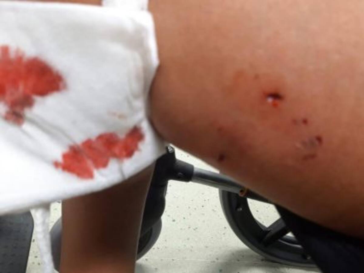 Sufre lesiones importantes en una mano tras ser mordida por un perro y el dueño abandona el lugar