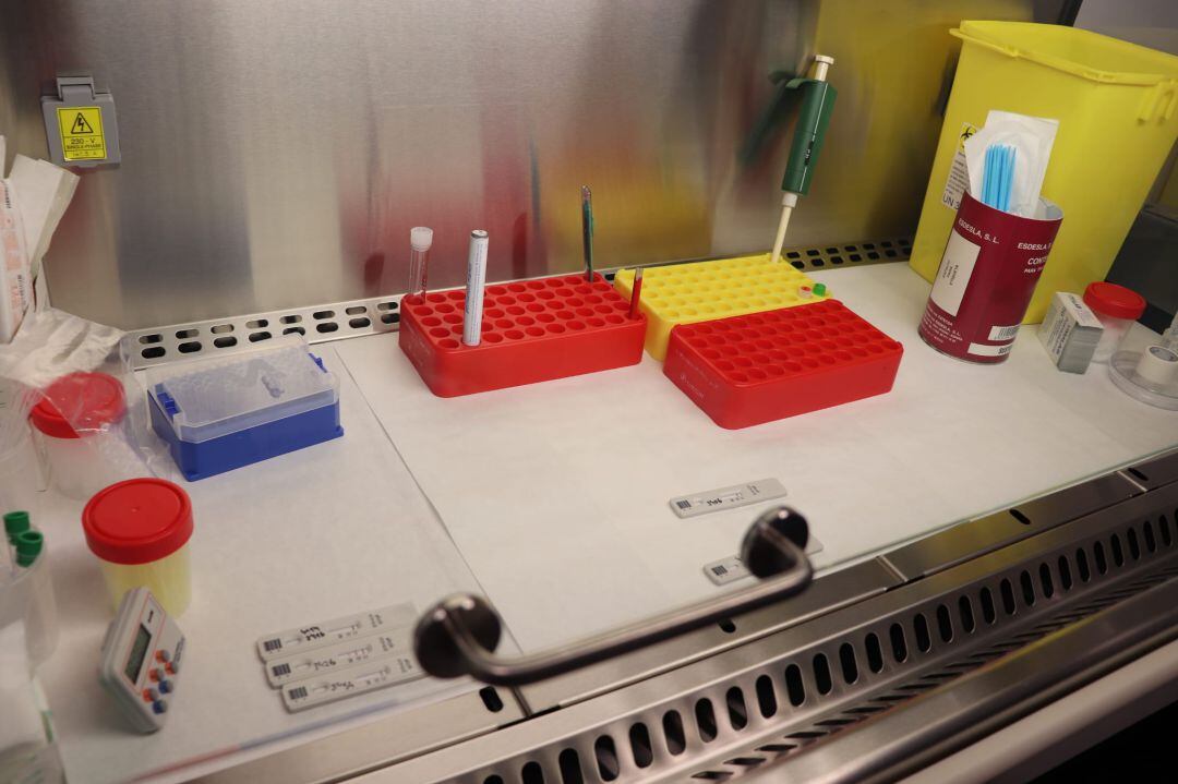 Pruebas de detecciòn en el laboratorio de Can Misses