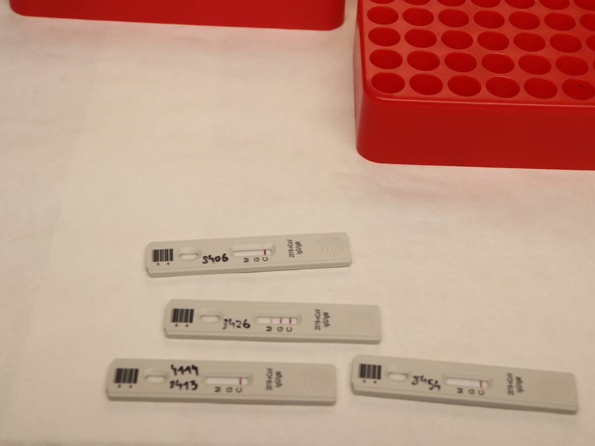 Fallecen en Ibiza dos hombres de 51 y 90 años con coronavirus