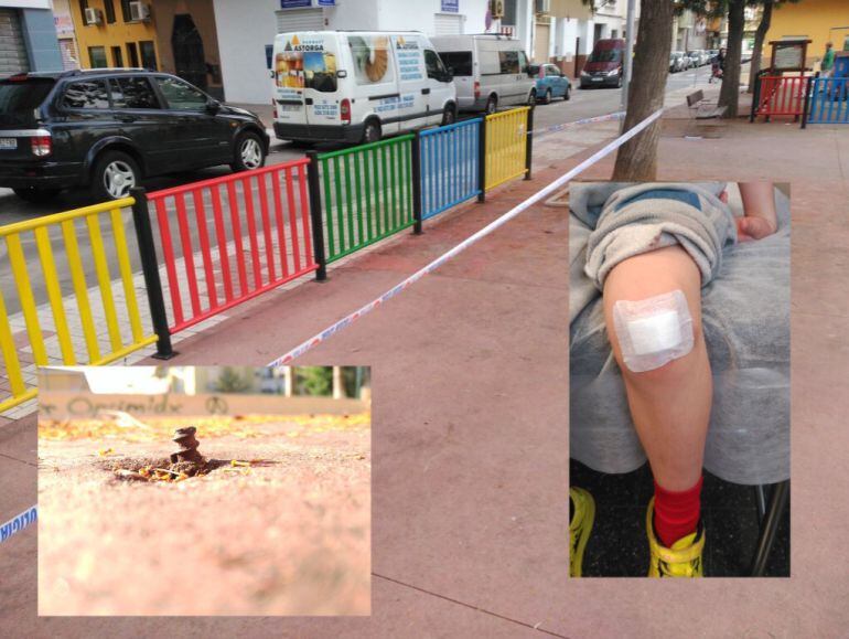 El parque infantil (situado en la Carretera de Cádiz), el clavo y el niño que ha tenido que ser atendido en el Materno por la herida