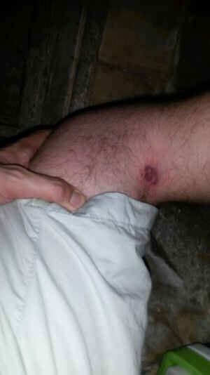 Heridas en vecinos de Torre del Compte