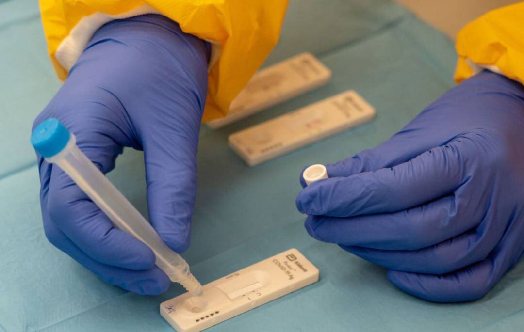 Pruebas para la detección de la Covid-19