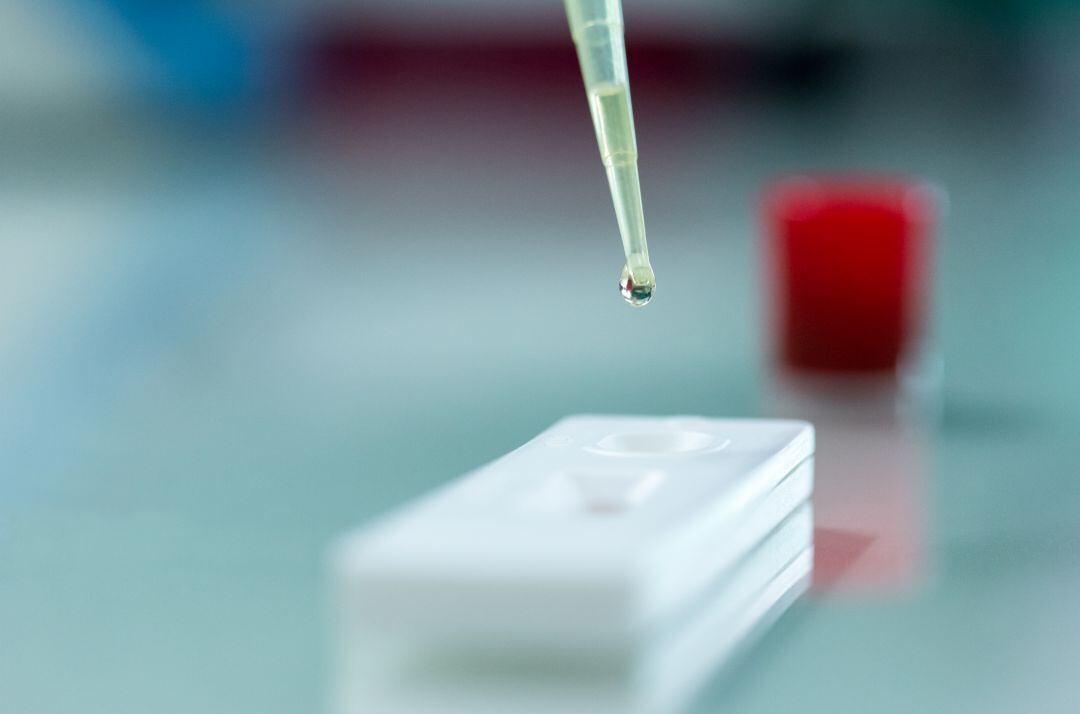 La sensibilidad y especificidad obtenida es superior a la que presentan los test de antígenos y algo inferior a la de la PCR, si bien este kit es mucho más rápido y sencillo de hacer.