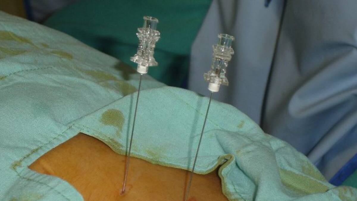 Una lista de espera paralizada por unas agujas que cuestan 27 euros