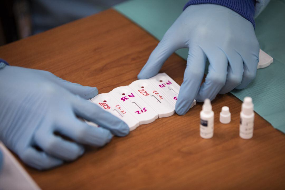 Test de cribado del Covid-19 en una imagen de archivo.