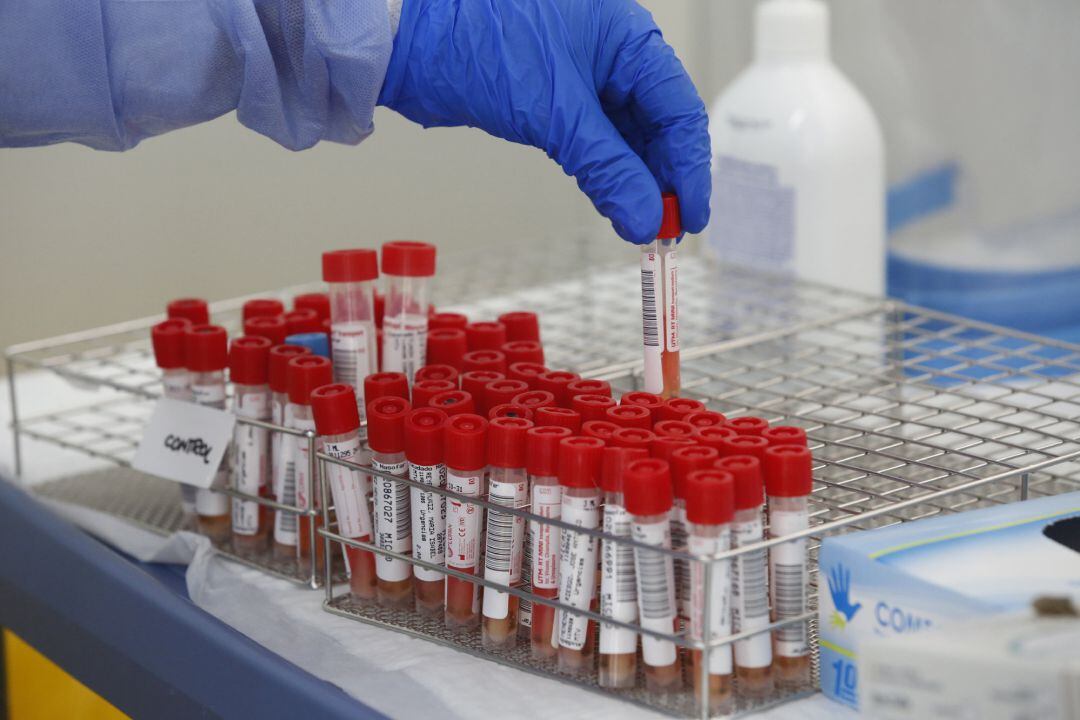 Tubos de pruebas PCR para la detección del COVID-19 en una carpa habilitada para hacer tests de detección de coronavirus, en una imagen de archivo