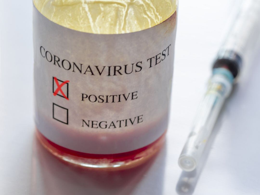 Test de coronavirus con resultado positivo