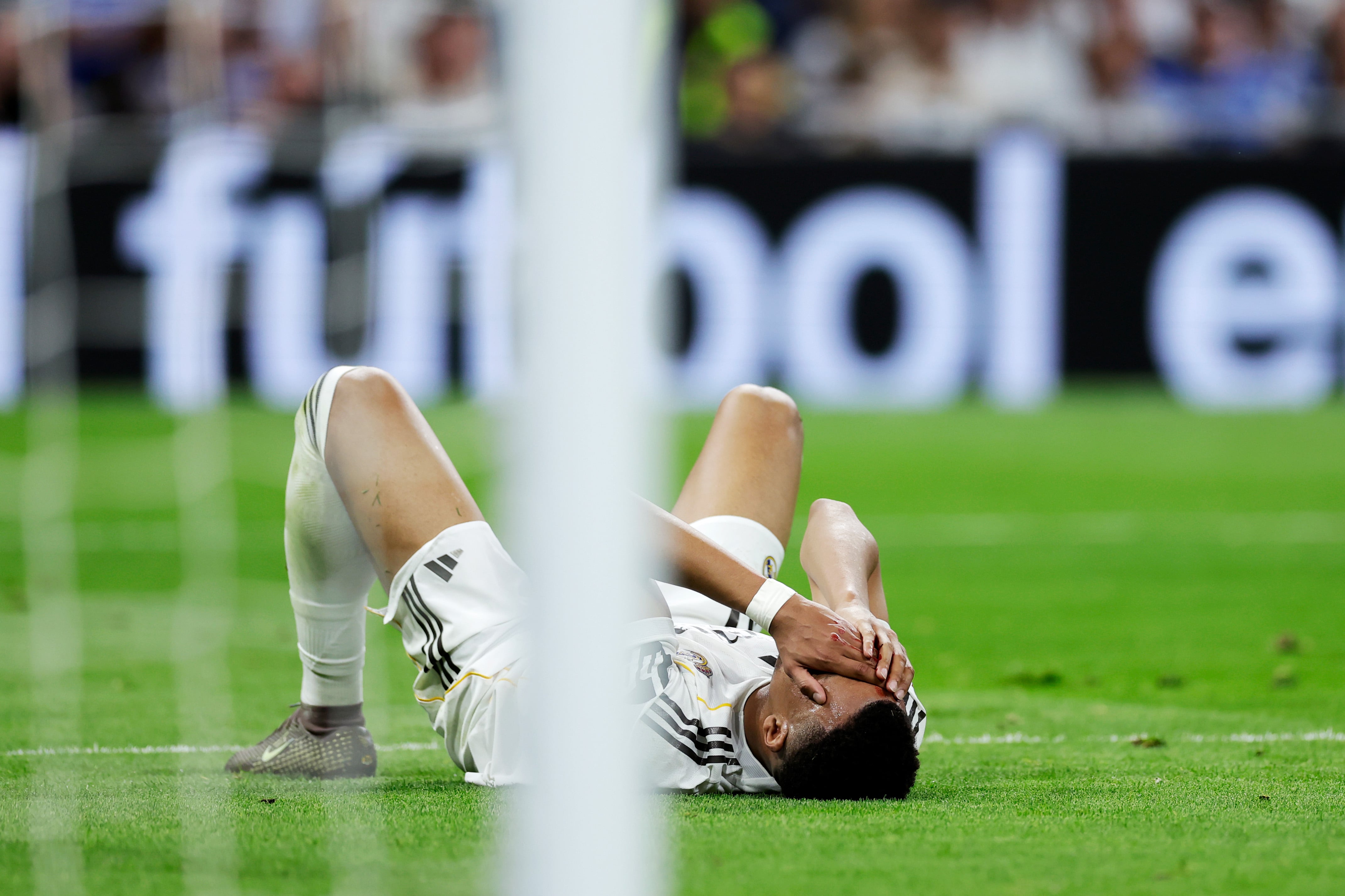 Mbappé cubriéndose la cara tras el golpe con Vitor Reis