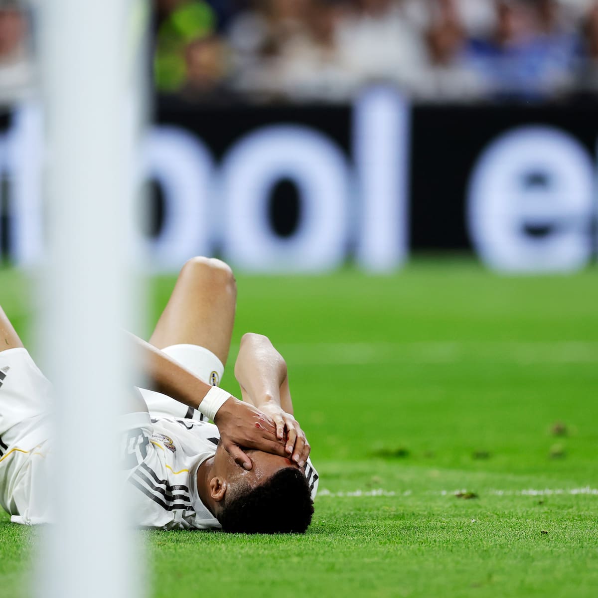 Mbappé, con puntos en la ceja tras el duro golpe ante el Girona