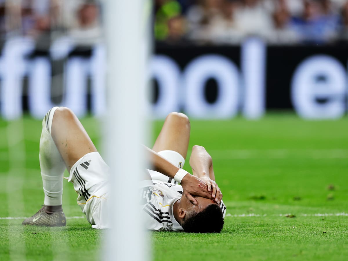 Mbappé, con puntos en la ceja tras el duro golpe ante el Girona