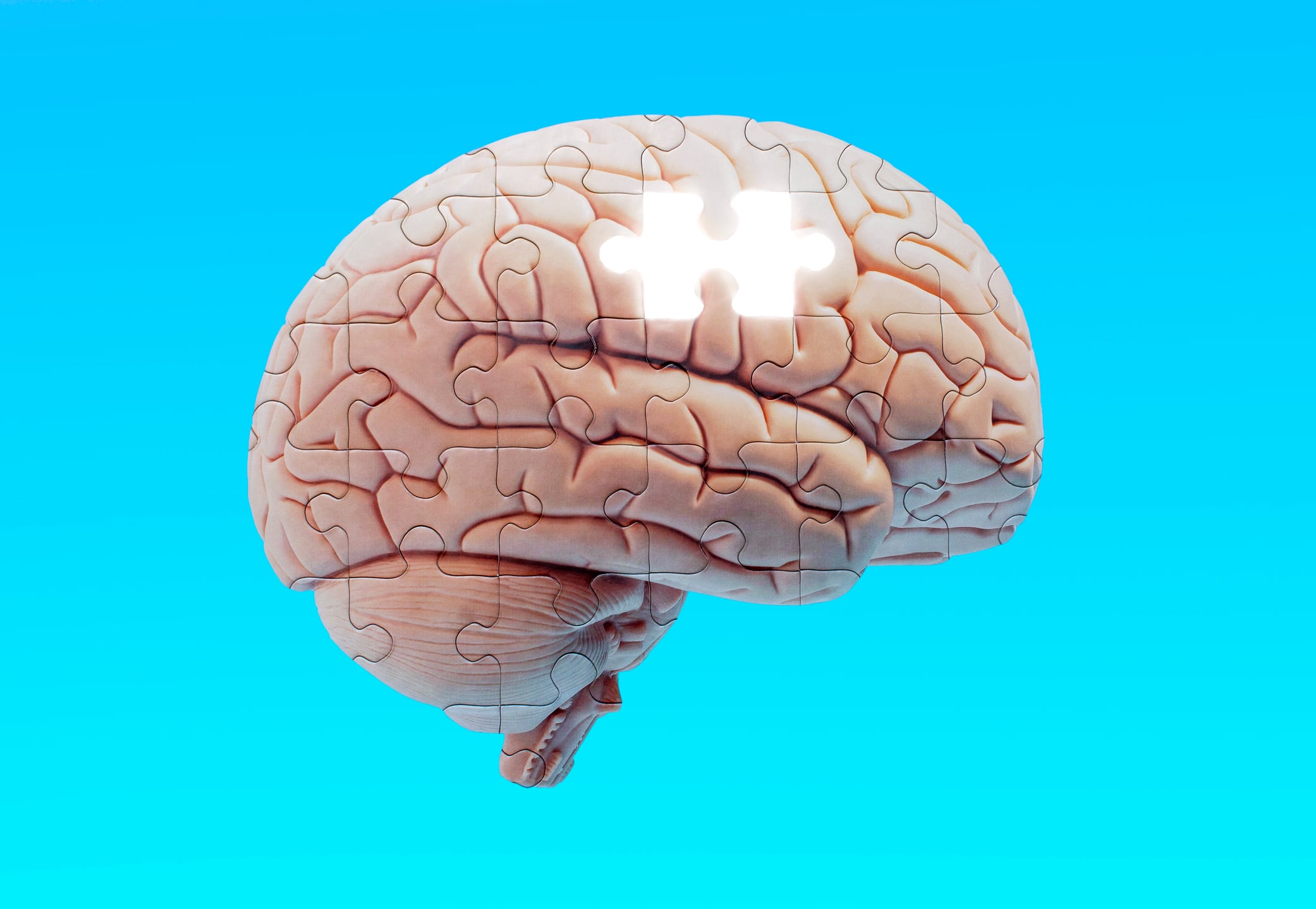 “Más allá de la memoria”: AFA Guardo organiza una semana de divulgación clave para visibilizar las demencias