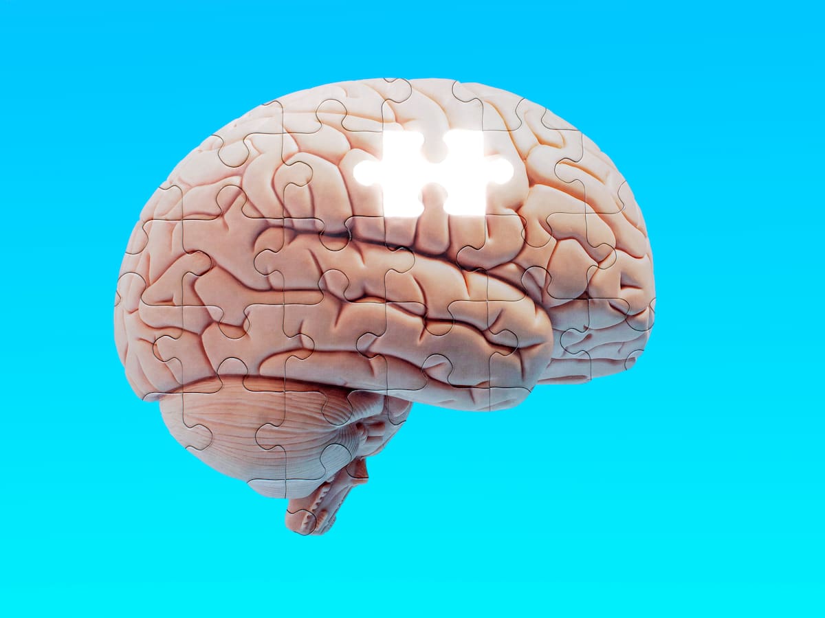 “Más allá de la memoria”: AFA Guardo organiza una semana de divulgación clave para visibilizar las demencias