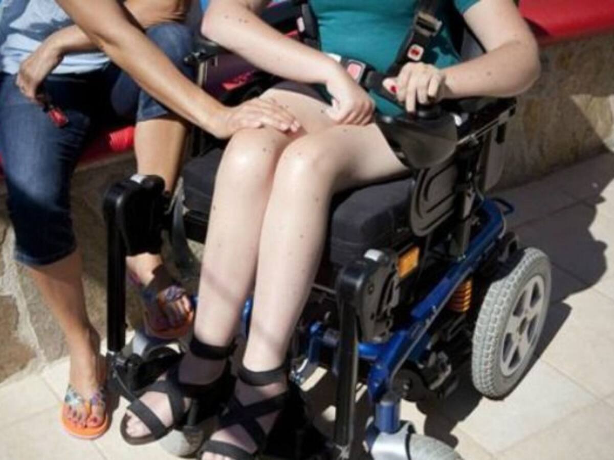 Madrid, una de las comunidades más estrictas al valorar la discapacidad