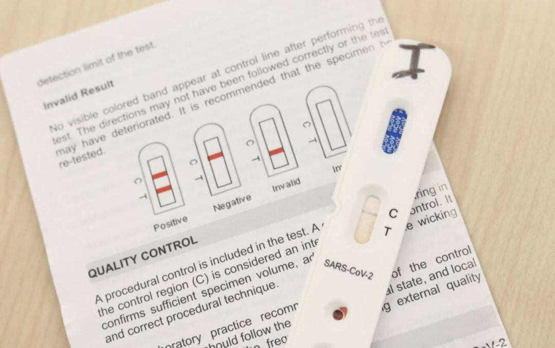 Empresas navarras compran más de 1.000 test rápidos para sus empleados 