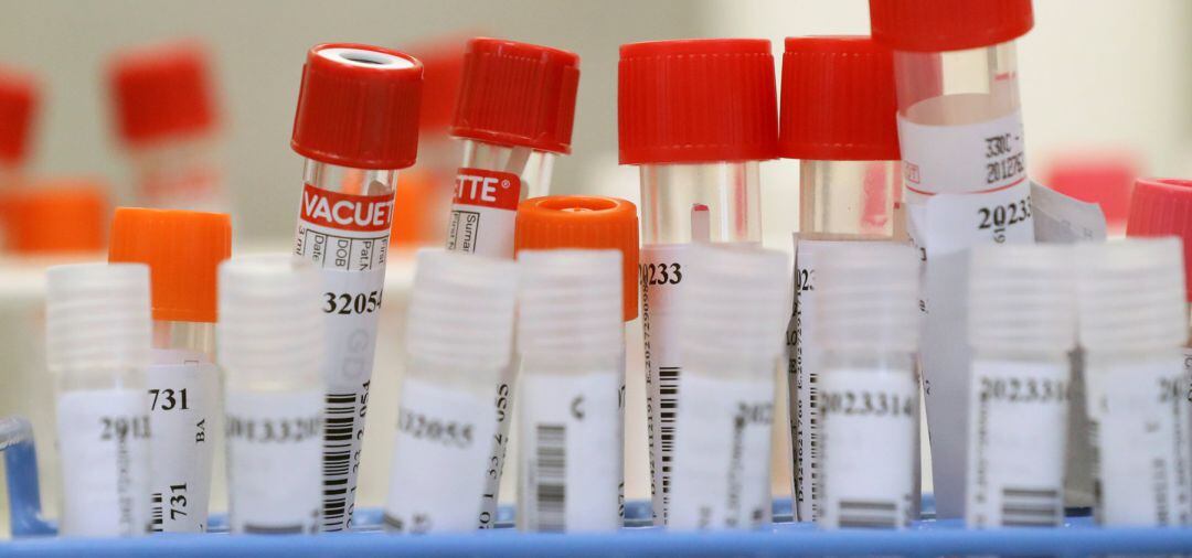 Muestras de sangre en un laboratorio.