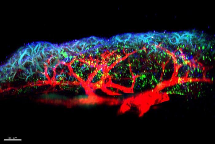 Visualización microscópica de las células inmunitarias (en verde) activadas por las alarmas TL1A e interleucina-33 durante la aparición de la inflamación alérgica en los pulmones. Las células inmunitarias ILC2 producen grandes cantidades de interleucina-9, un mediador clave de la inflamación alérgica. Se localizan cerca de las fibras de colágeno (azul) y de los vasos sanguíneos del pulmón (rojo).
CRÉDITO
© Jean-Philippe GIRARD - IPBS (CNRS/UT3 Paul Sabatier)