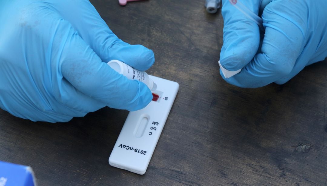 Un sanitari opera un test d&#039;antígens