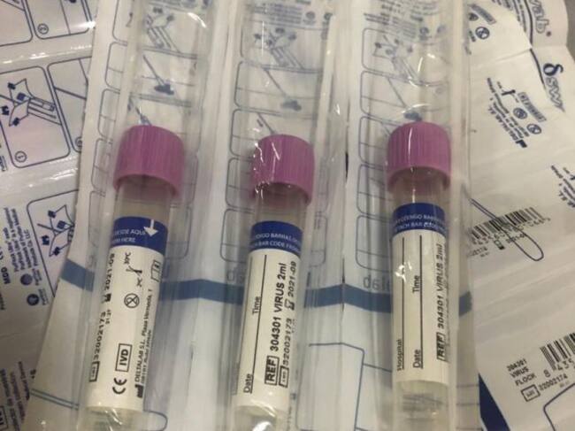 Imagen de test rápido