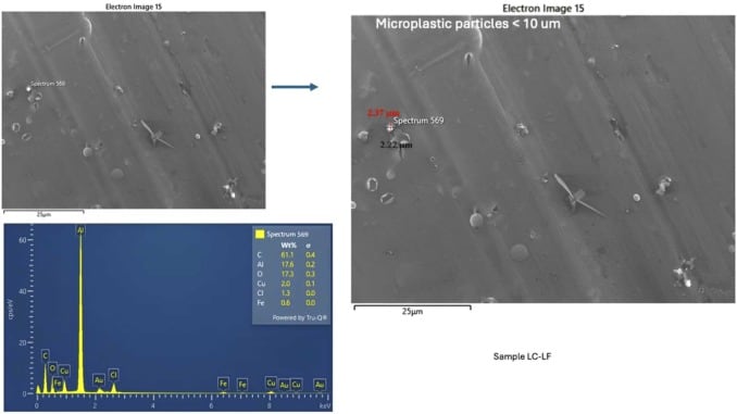 Concentración de microplásticos en muestras de líquido folicular. Ecotoxicology and Environmental Safety.