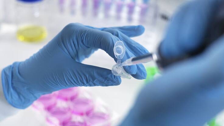 Investigación para extraer el patrón de contagio del coronavirus