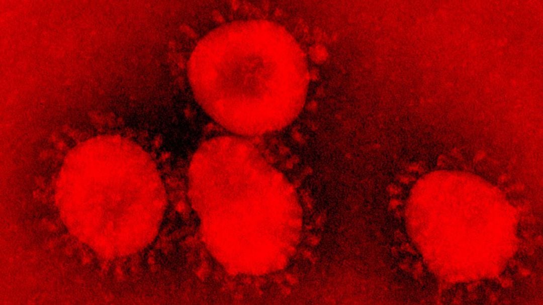 Coronavirus