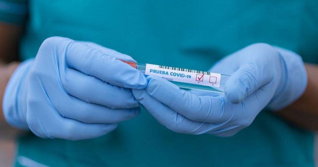Una prueba de Covid-19.