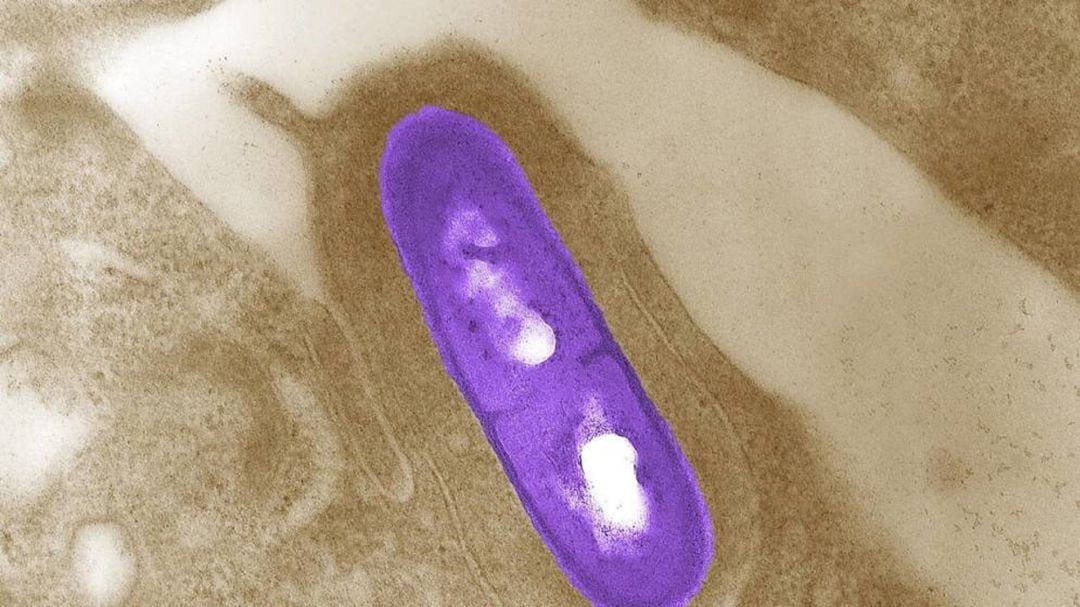 Imagen microscópica de una bacteria Listeria monocytogenes