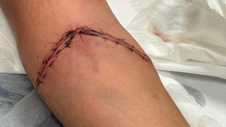 Corte de un menor en San José Artesano