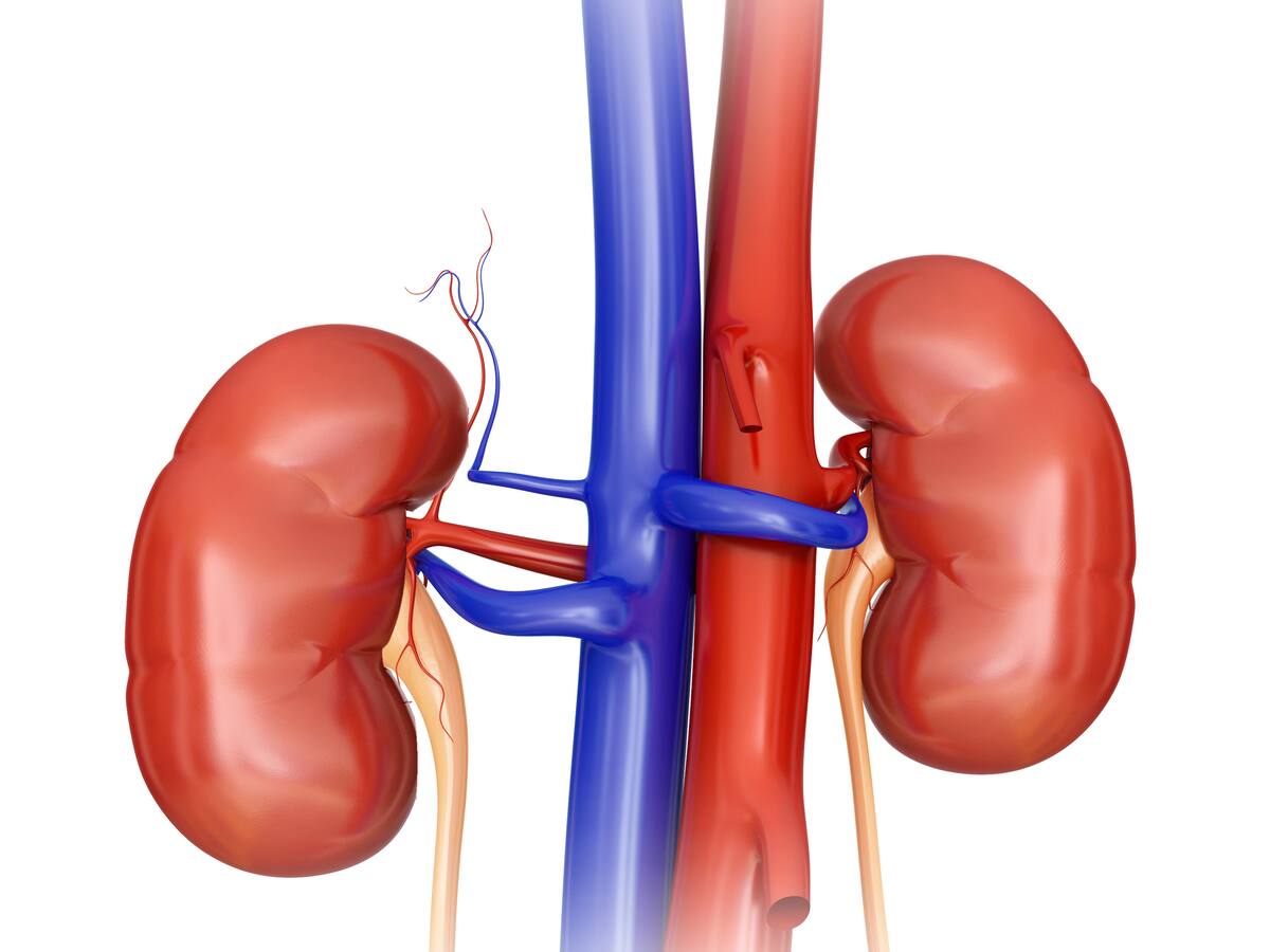 Síntomas de piedras en los riñones