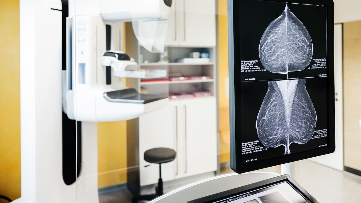 Catalunya estudia aplicar la IA a les mamografies per poder ampliar els cribratges de càncer