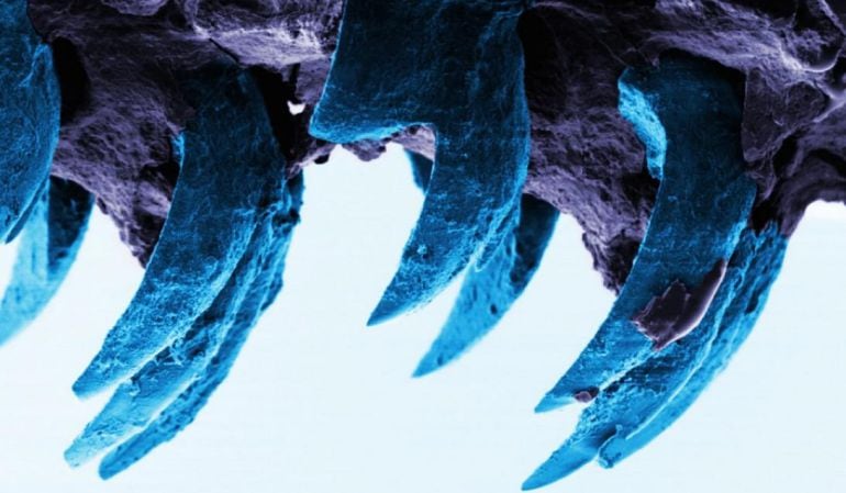 Imagen microscópica de los dientes de lapa.