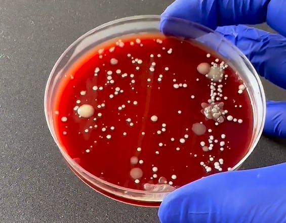 El vídeo muestra las bacterias de un móvil sin higienizar.