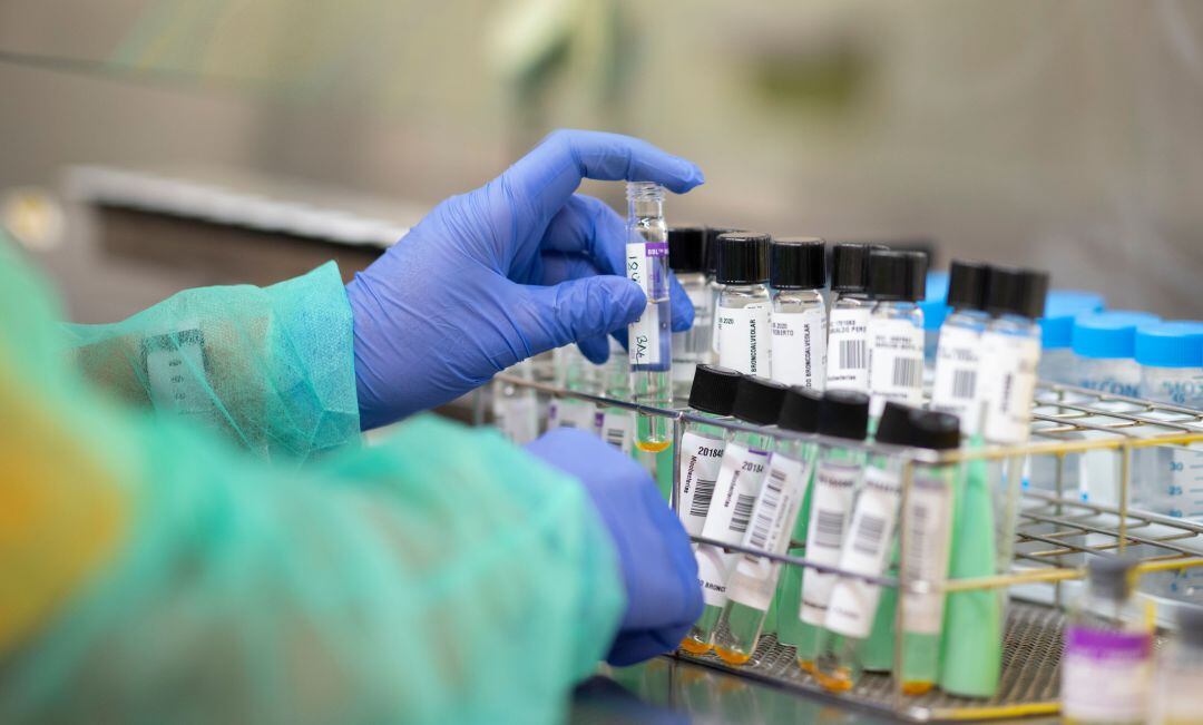 Muestras de PCR para analizar