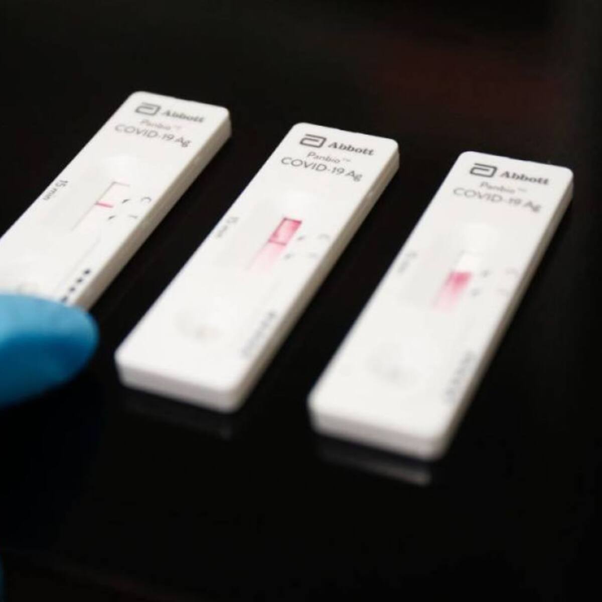 La incidencia covid vuelve a bajar en Cantabria y se acerca a los 400 casos