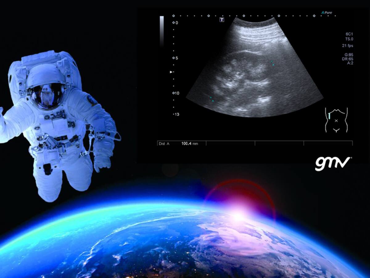 Del espacio a los hospitales: el proyecto que busca acelerar los diagnósticos en atención primaria