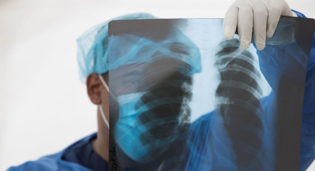 Un especialista observa este miércoles la radiografía de una paciente.