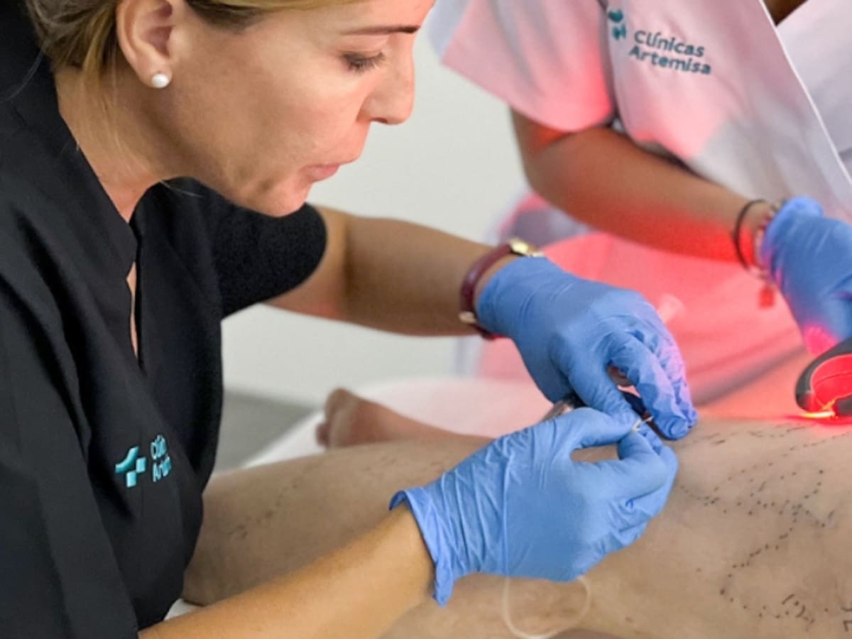 Varices: mucho más que un problema estético