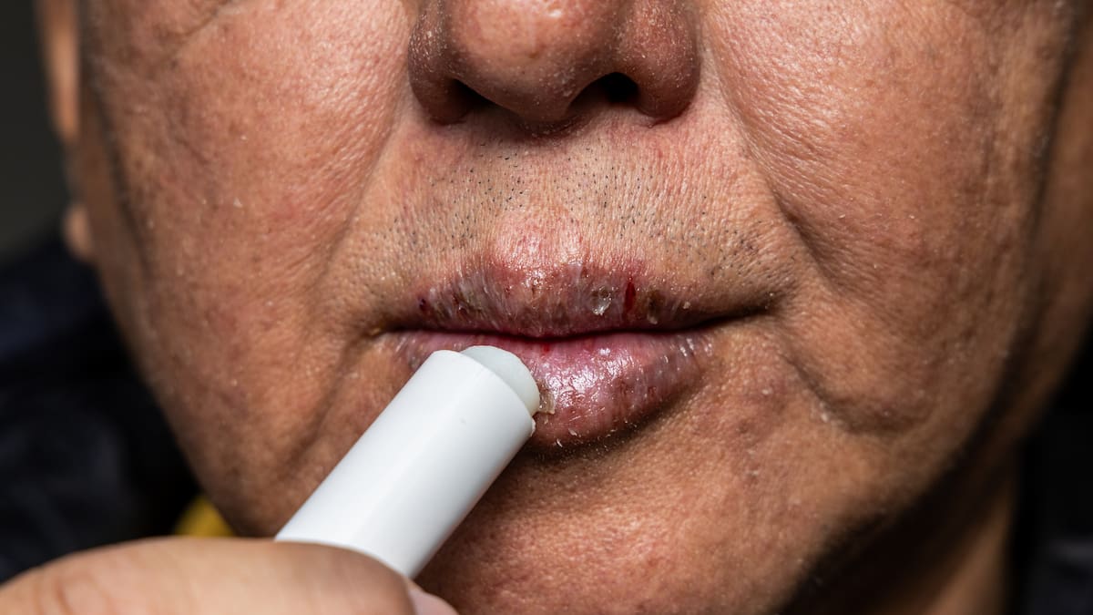 La Rebotica: Cómo cuidar las manos y los labios en invierno