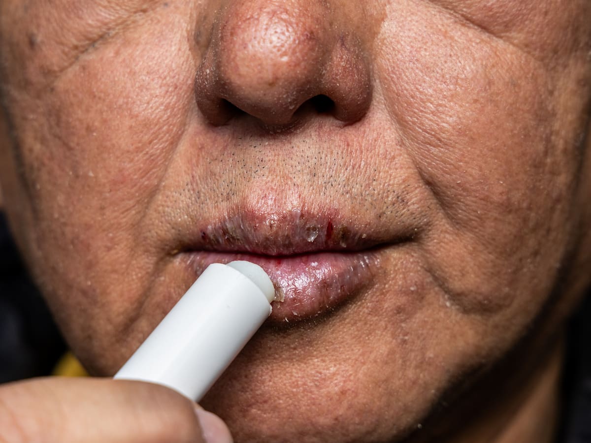 Cómo cuidar las manos y los labios en invierno: guía definitiva para evitar grietas, sequedad y sabañones