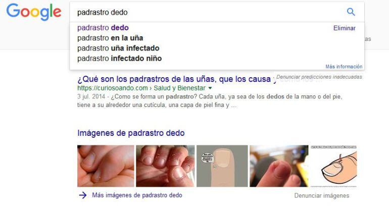 La googleitis o cibercondría es cada vez más habitual