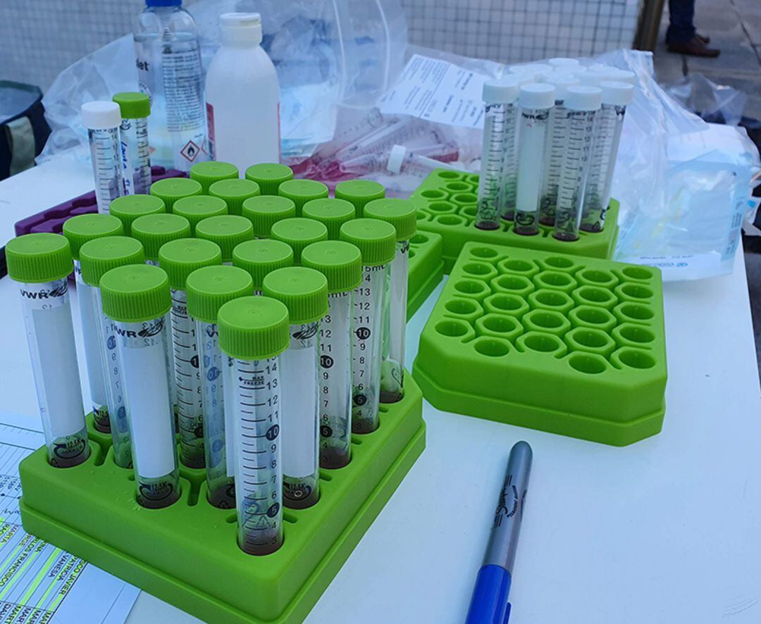 Muestras recogidas para realizar una prueba PCR.