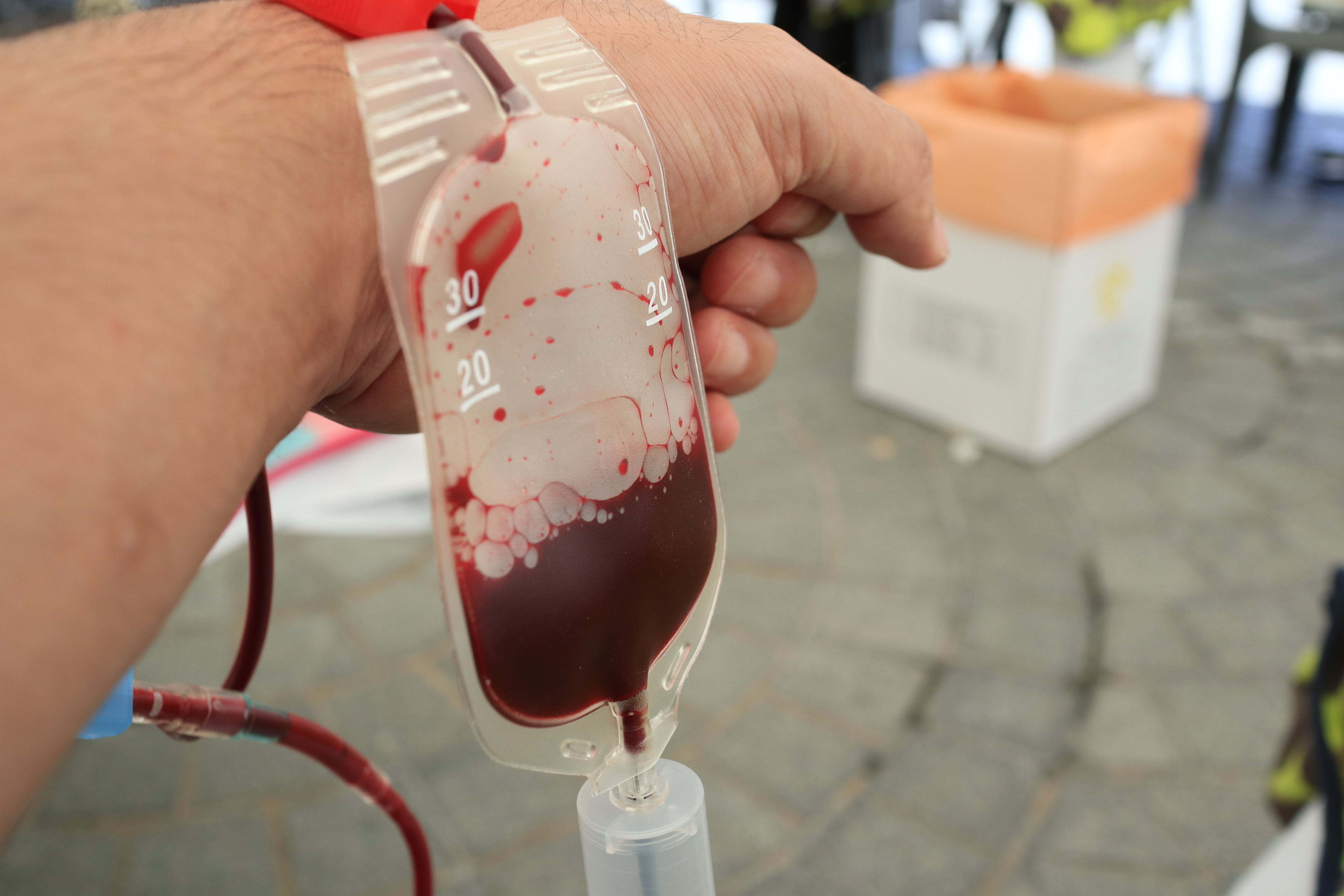 Mano de un donante (Getty Images).