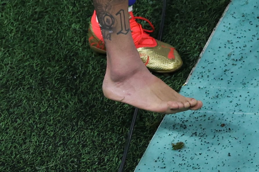 Fotografía del tobillo de Neymar tras su lesión. (Photo by Giuseppe CACACE / AFP) (Photo by GIUSEPPE CACACE/AFP via Getty Images)