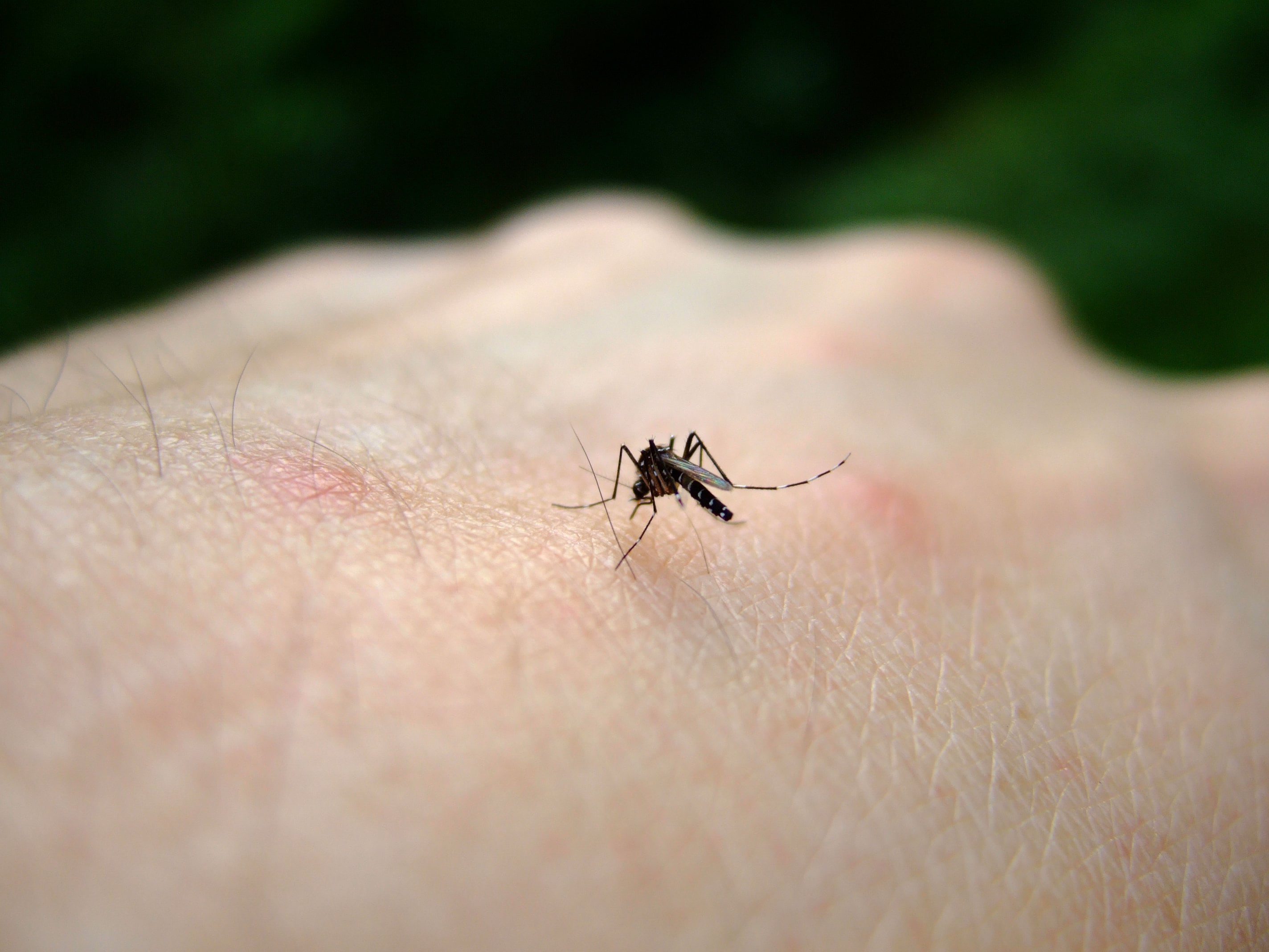 Un mosquito posado en la mano de una persona.