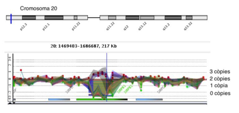 En el gràfic: a cada banda de la regió central, la línia horitzontal es manté constant en un valor a prop de zero, indicant que no hi ha diferències entre els genomes comparats. En la regió central de la imatge veiem que la línia baixa en aquelles persones que tenen menys de dos còpies (una o zero) o bé puja per aquelles que tenen tres o més còpies. És en aquesta regió central on es troba el gen SIRPB1.