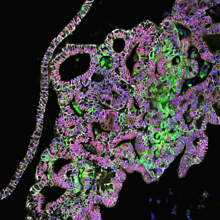 Esta imagen microscópica muestra tejidos de estómago humano fabricados en un laboratorio con células madre y que producen enzimas digestivas. 