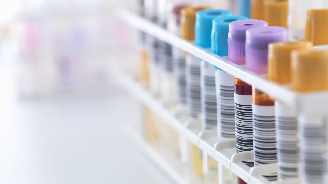 Rivera ha explicado en Hoy por hoy de qué va su tesis, comenzando por explicar qué es la arritmia cardiaca