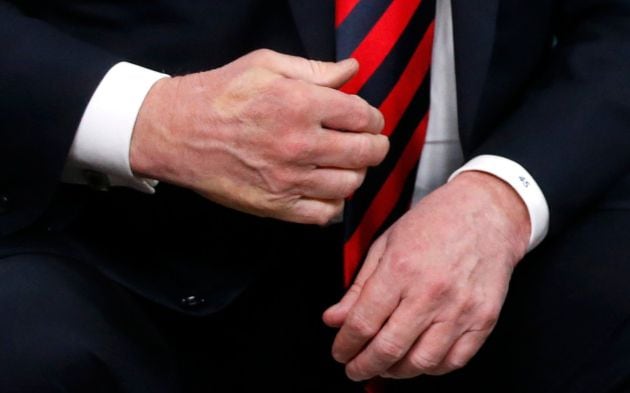 La mano de Trump tras el saludo con Macron.